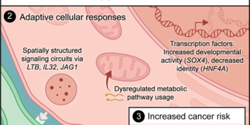 高脂饮食如何诱发肝癌？《Cell》揭示肝细胞“逆生长”癌变机制与潜在预防靶点SOX4