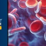 Epcoritamab和Glofitamab治疗R/R LBCL：真实世界疗效、早期进展风险与后续挽救方案解析