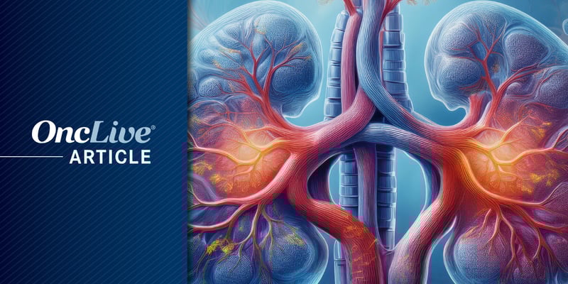 肾细胞癌IVC瘤栓治疗新突破：新辅助SAbR放疗联合手术，RFS生存率显著提升