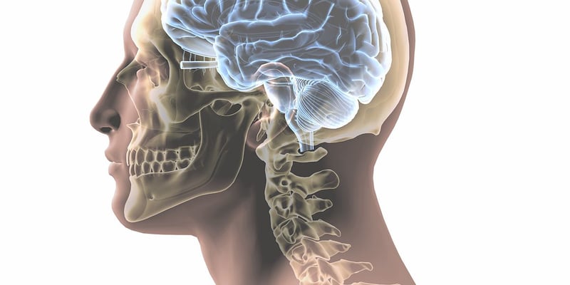 复发性头颈部鳞癌（HNSCC）治疗新希望：顺铂/紫杉醇联合再程放疗的长期生存数据与毒性风险解析