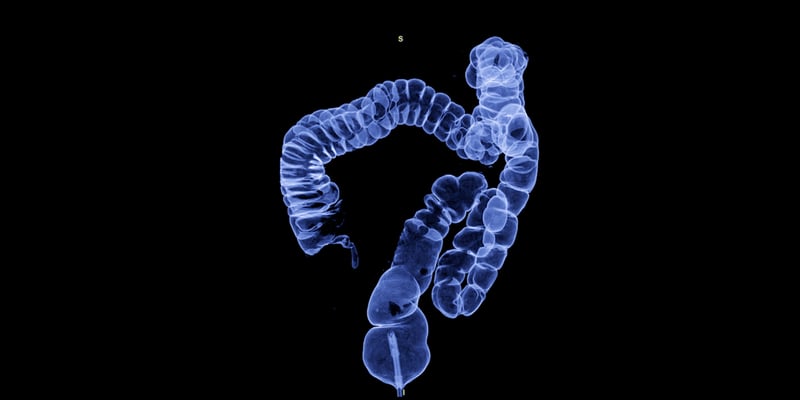 BRAF V600E突变结直肠癌患者福音：康奈非尼三联方案带来新希望，附海外购药指南