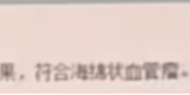 海绵状血管瘤GNA14突变怎么办？西罗莫司靶向治疗带来新希望！