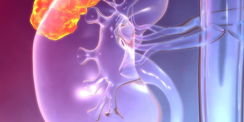 转移性肾癌治疗新希望：粪菌移植（FMT）联用免疫疗法，PFS显著延长！