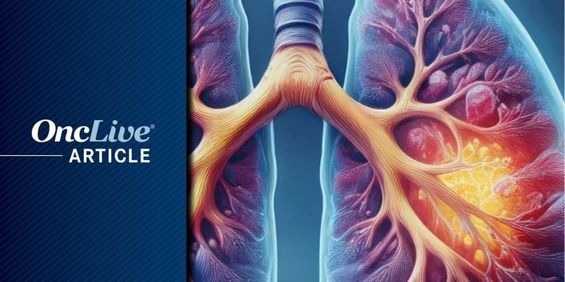 NSCLC新药时代：ADC与免疫治疗的副作用管理与用药选择指南