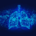 晚期非小细胞肺癌：双免疫治疗优于单免疫？权威研究揭示特定患者群体受益真相