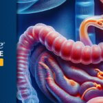 胃癌新辅助治疗新突破：CRITICS-II研究揭示化疗联合放化疗更优方案