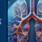 Ceralasertib联合Durvalumab治疗晚期NSCLC三线失败：LATIFY试验OS数据解读与后续治疗选择