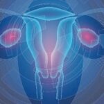 宫颈癌患者必看：营养不良如何影响放化疗效果？专家教你科学应对！