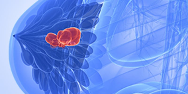 绝经前淋巴结阳性乳腺癌患者福音：延长内分泌治疗显著降低复发！