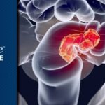 阿替利珠单抗+贝伐珠单抗治疗转移性结直肠癌：MSI-like患者疗效不佳？最新II期临床数据深度解读