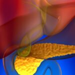 胰腺癌治疗新突破：多抗原靶向T细胞疗法临床研究展现惊人疗效，为患者带来新希望