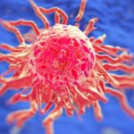 NCCN发布儿童横纹肌肉瘤最新诊疗指南：实现治愈与最小化副作用的平衡