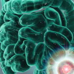 重磅！mFOLFOXIRI联合帕尼单抗，显著延长RAS/BRAF野生型转移性结直肠癌患者生存期！