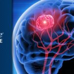 溶瘤病毒免疫疗法：攻克胶质母细胞瘤，延长患者生存期新希望