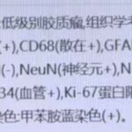 KIAA1549-BRAF融合阳性毛细胞型星形细胞瘤：基因检测、治疗选择及药物获取全攻略