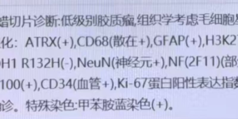 KIAA1549-BRAF融合阳性毛细胞型星形细胞瘤：基因检测、治疗选择及药物获取全攻略