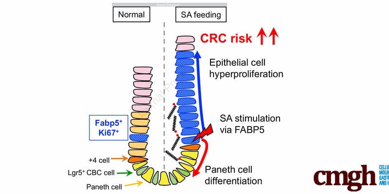 警惕膳食硬脂酸：黄油巧克力不发胖也促肠癌？揭秘结直肠癌饮食预防新靶点FABP5