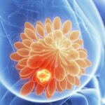 循环肿瘤DNA（ctDNA）在乳腺癌治疗中的突破：预测复发、耐药监测与精准用药策略