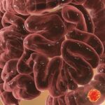 重磅！II/III期结直肠癌辅助化疗，3个月与6个月疗效无显著差异？SCOT研究终极揭秘