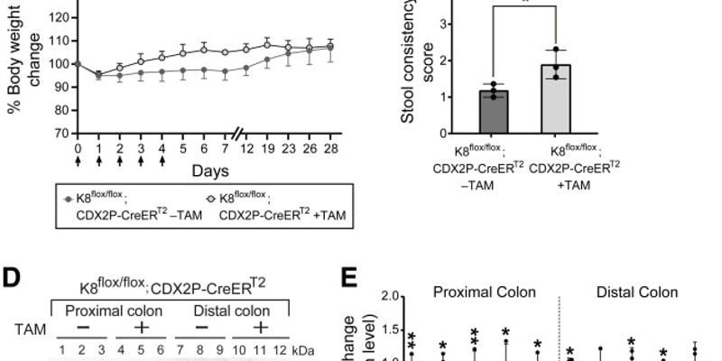 角蛋白8：结直肠癌的“细胞骨架守护神”？深度解析肿瘤发生新机制与治疗潜力