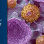 骨肉瘤肺转移新希望！OST-HER2药物FDA加速审批，预防复发疗效惊人！