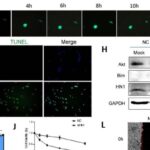 甲状腺未分化癌转移之谜终揭晓：HN1成治疗新靶点，索拉非尼疗效有望提升！