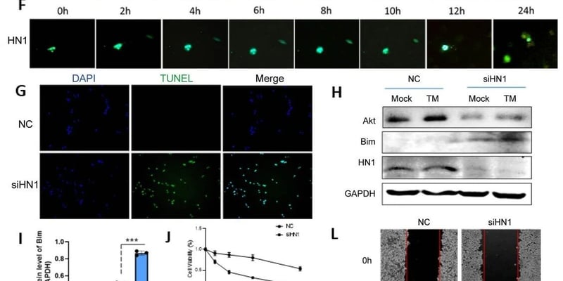 甲状腺未分化癌转移之谜终揭晓：HN1成治疗新靶点，索拉非尼疗效有望提升！