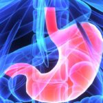 胃癌患者必读：胃切除术后胆结石风险猛增，如何预防与管理？MedFind为您揭秘