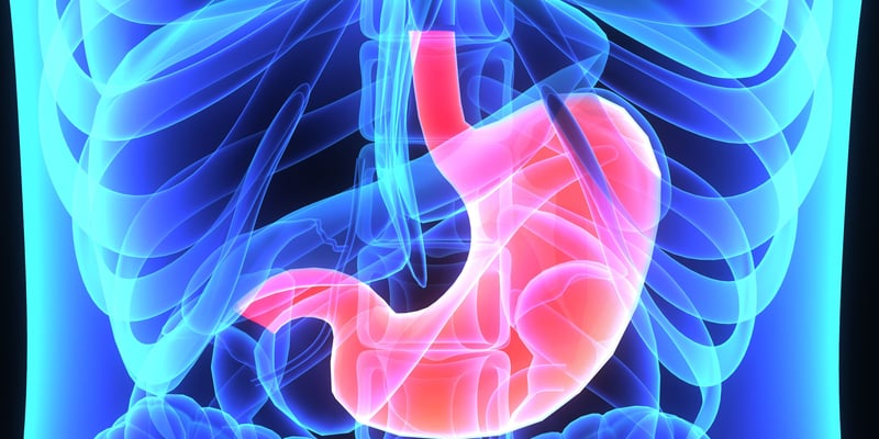 胃癌患者必读：胃切除术后胆结石风险猛增，如何预防与管理？MedFind为您揭秘