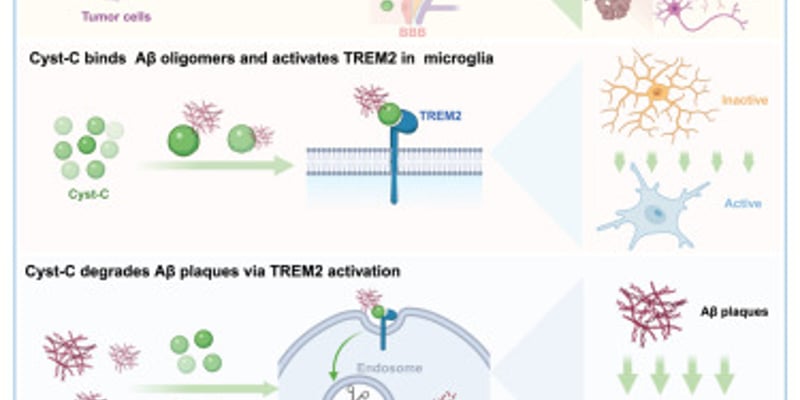 癌症与阿尔茨海默病的“跷跷板”效应：胱抑素C如何清除脑内斑块，为AD治疗带来突破？