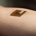 告别复杂检查！新型智能贴片如何实现皮肤癌、黑色素瘤的居家早期筛查？