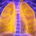 重磅！埃万妥单抗获FDA批准：EGFR突变非小细胞肺癌月度皮下注射新方案，用药更便捷