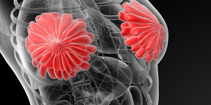 HER2阳性乳腺癌减毒新策略：neoCARHP研究证实THP方案不亚于含铂方案