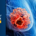 乳腺癌放疗重大突破：仅需5天，让“不可切除”肿瘤显著降期！