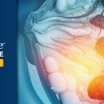 HER2低表达乳腺癌用药指南：优赫得（DS-8201）真实世界安全性及副作用应对全解析