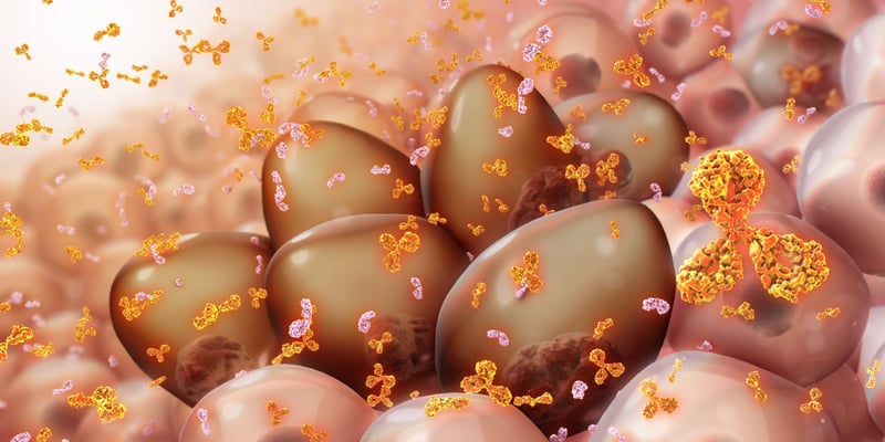 96%总缓解率！双靶向CAR-T疗法AZD0120为多发性骨髓瘤患者带来新曙光