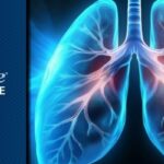 HER2阳性乳腺癌生存希望：靶向新药重塑治疗格局与跨境获取指南