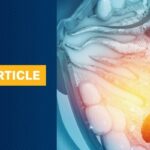 2026乳腺癌治疗新突破：FDA最新获批进展与新药临床数据全解析