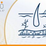 晚期黑色素瘤脑转移新希望：深度解析首款TIL疗法Lifileucel的生存突破