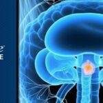 抽血就能免切膀胱？RETAIN-2研究揭秘ctDNA在膀胱癌精准治疗中的新进展