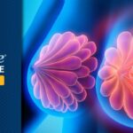 精准打击PIK3CA突变！乳腺癌新药Zovegalisib联合方案缓解率破66%