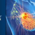 乳腺癌新药吉瑞斯群临床喜忧参半？解析ESR1突变治疗新突破