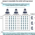 非小细胞肺癌(NSCLC)PD-L1检测：EGFR突变如何影响免疫治疗选择？