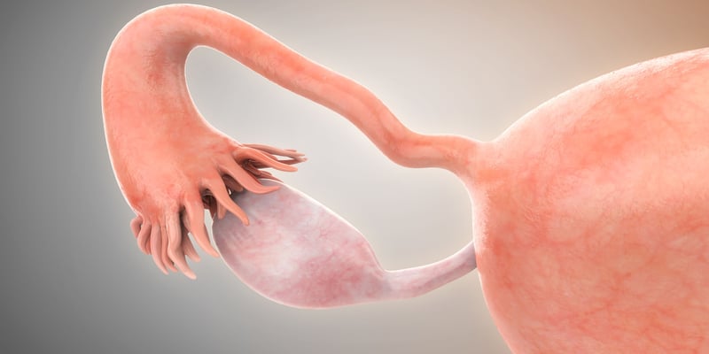 铂耐药卵巢癌新希望：帕博利珠单抗联合疗法欧洲获推荐，显著延长OS