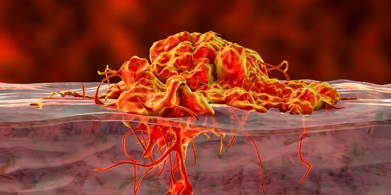 2026年罕见黑色素瘤治疗新突破：延长生存期的关键药物与疗法