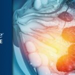 阻击三阴性乳腺癌转移：揭秘癌细胞隐身术，老药米非司酮或成免疫治疗新利器