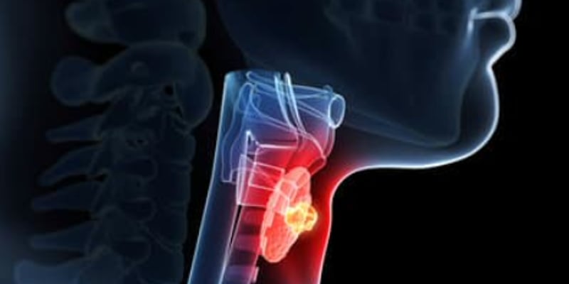 司美格鲁肽致癌风险深度调查：甲状腺癌患者还能放心使用减肥药吗？