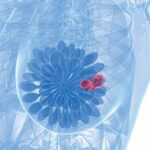 三阴性乳腺癌迎来“救命组合”！德达博妥单抗联用免疫治疗，有效率突破80%