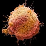 NPTAC纳米颗粒疗法：难成药癌蛋白有望被直接降解