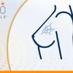 HR阳性HER2阴性乳腺癌基因检测怎么选